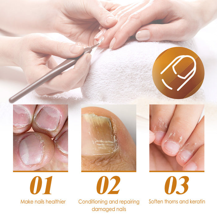 Hand & Foot Nail Care Solution with Aloe & Vitamin E 30 ml EELHOE COSMETICS