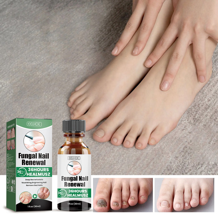 Nail Strengthening Care Liquid with Sophora Root Extract, 30 ml EELHOE COSMETICS