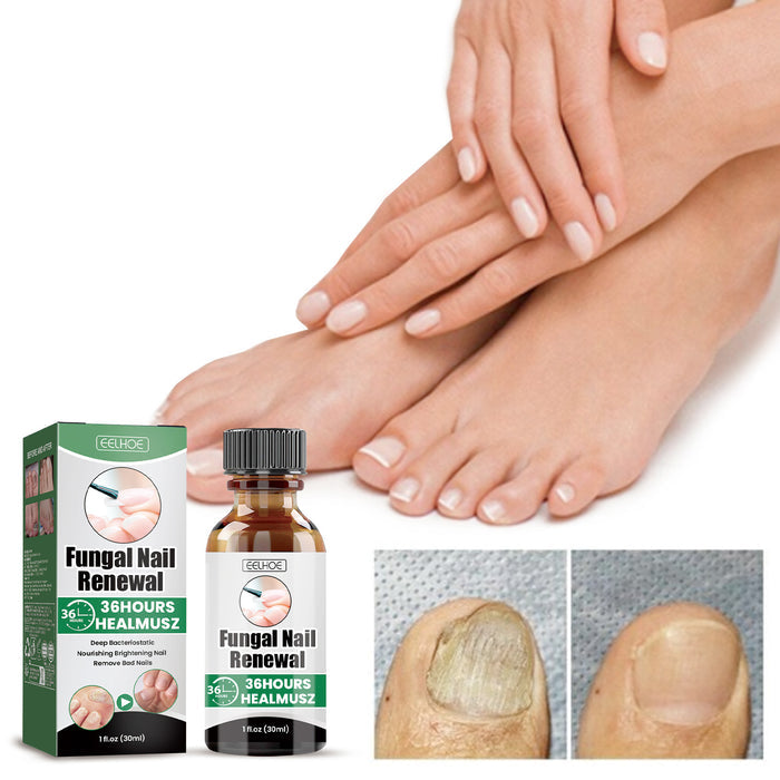 Nail Strengthening Care Liquid with Sophora Root Extract, 30 ml EELHOE COSMETICS
