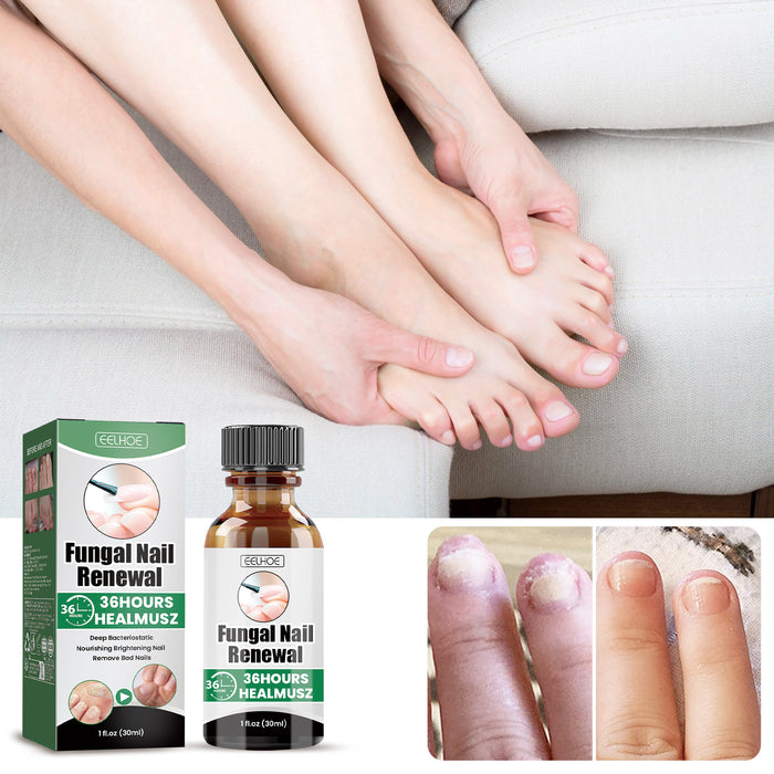 Nail Strengthening Care Liquid with Sophora Root Extract, 30 ml EELHOE COSMETICS